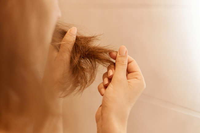 Rambut Mudah Rontok, Bisa Jadi Ini Masalahnya