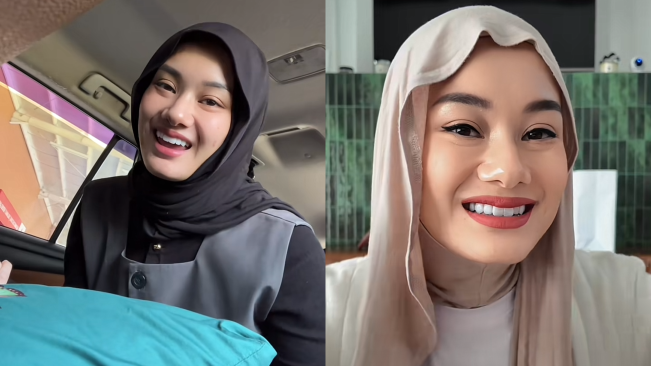 Netizen Komentari Perubahan Penampilan Dinda Hauw Usai Veneer Gigi