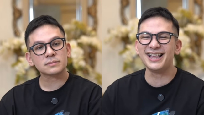 Jordi Onsu Blak-blakan Akui Operasi Hidung, Tak Mau Pakai Alasan Karena Sinus