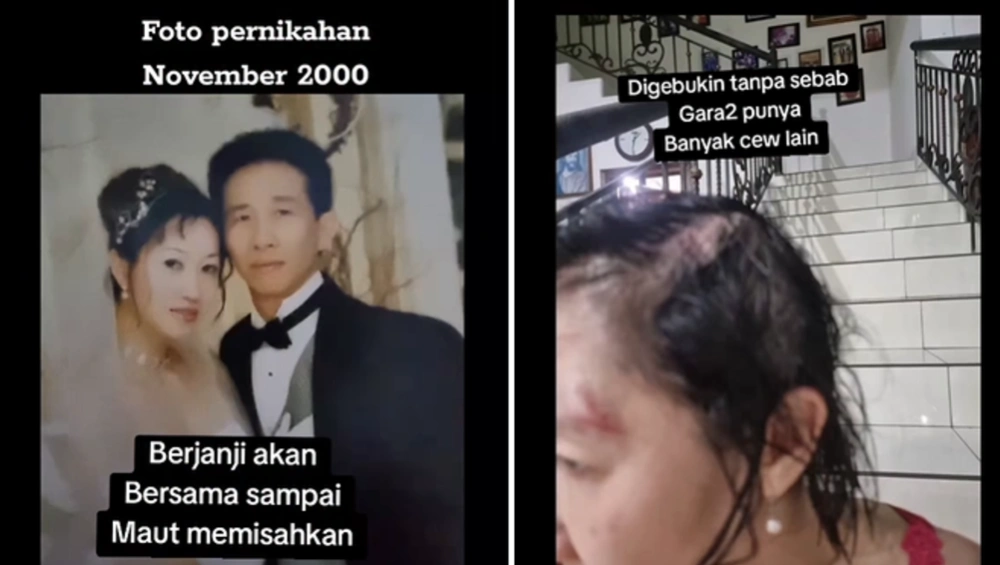 Kolase pernikahan Sherly dan kondisi saat Sherly dapat pukulan dari suami (TikTok)