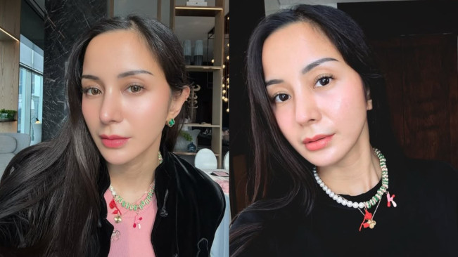 Keluar Uang Rp200 Juta untuk Operasi Plastik Hidung, Kirana Larasati Santuy