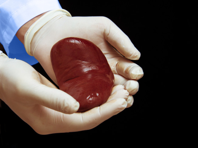 Ahli Uji Coba Transplantasi Jantung dan Ginjal Babi ke Tubuh Manusia