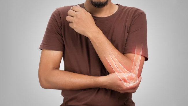 Waspada, Ini 5 Efek Samping Minum Collagen Cair