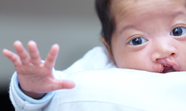 Setiap Tiga Menit, Bayi Terlahir dengan Kondisi Ini