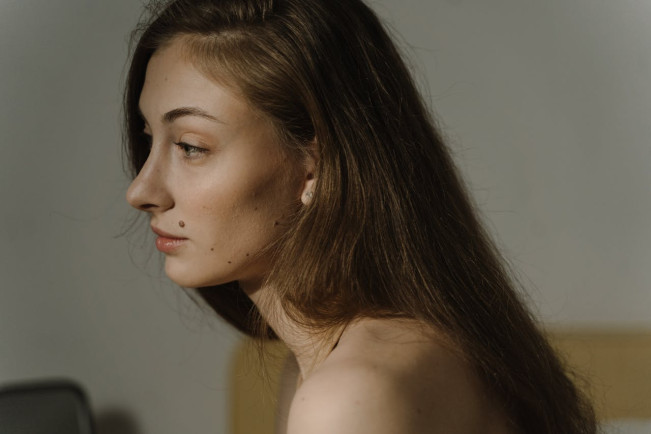 Dari Iritasi hingga Kanker Kulit, Fakta Penting soal Tahi Lalat Gatal