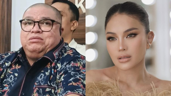 Nikita Mirzani Ngaku Luka di Pipi dan Kepala Gegara Adu Fisik Sama Razman Arif Nasution