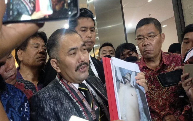 Bukan Hanya Ditembak, Brigadir J Diduga Disiksa oleh Sejumlah Orang