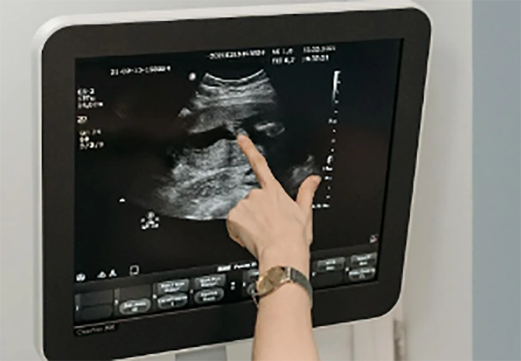 Ilustrasi [Foto: Pavel Danilyuk, pexels.com]