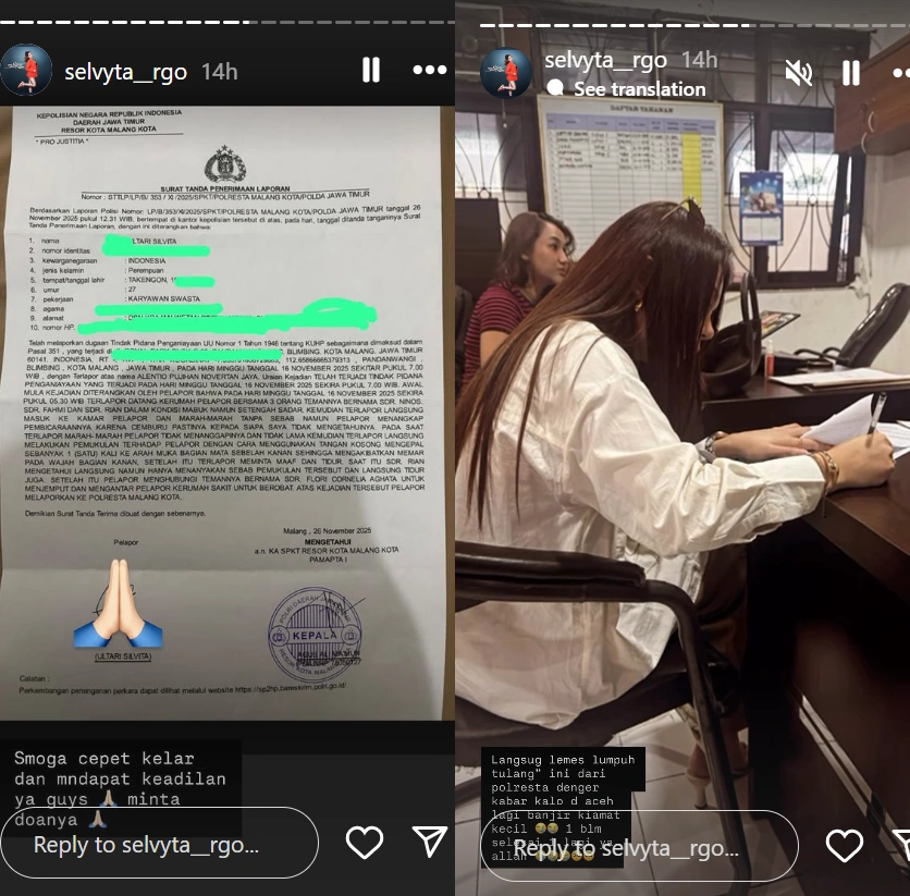 DJ Selvyta resmi membuat laporan atas kekerasan yang dilakukan sang pacar terhadapnya. [Instagram]