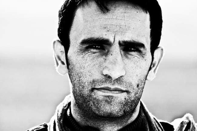 Ternyata Ini 5 Penyebab Flek Hitam pada Wajah