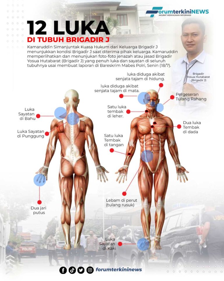 Infografis 12 Luka di Tubuh Brigadir J