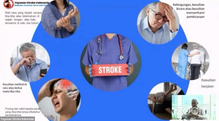 Kena Serangan Stroke? Lakukan Hal Ini dan Jangan Panik